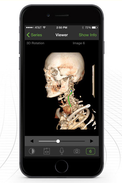 Pro Medicus imaging results on smartphone 600pxH